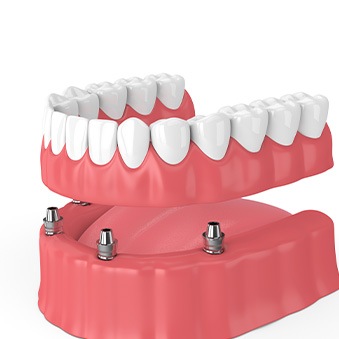illustration of dentures