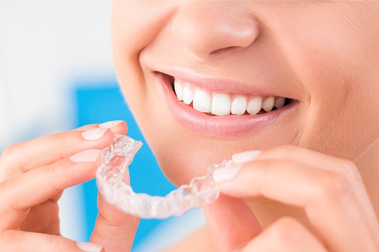 Closeup of a woman smiling as she puts in her Invisalign trays in Fort Smith, Arkansas