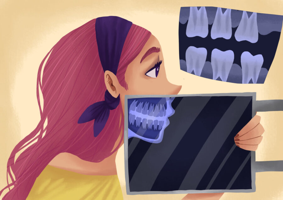 are dental x-rays safe